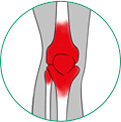 icone ilustrativo para artrite
