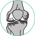 icone ilustrativo para artrose