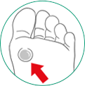 icone ilustrativo para bolhas nos pés