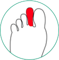 icone ilustrativo de dedo de morton