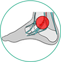 icone ilustrativo para tendinites na região do tornozelo e pé